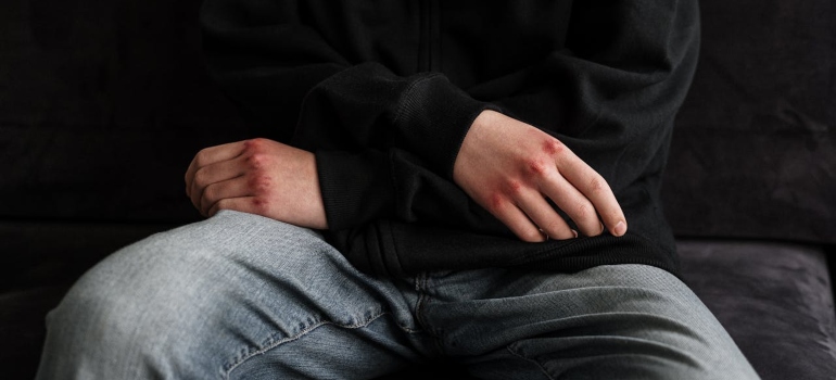 a boy with wounds on his hands